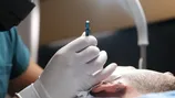 ترکیه میزبان گردشگران سلامت و کاشت مو در جهان