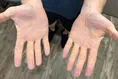 دانشمندان کشف کرده‌اند که تغذیه نامناسب باعث ایجاد رسوبات زرد عجیب و غریب روی پوست می‌شود