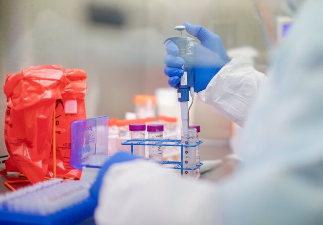 شرکت‌های دانش‌بنیان ساخت "آنزیم"‌های کیت‌های تشخیص کرونا را آغاز کرده‌اند