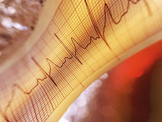 مرگ‌های ناشی از بیماری‌های قلبی بالاتر از فوتی‌های کروناست