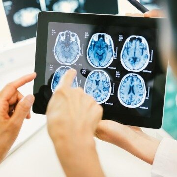 ابزاری نوین برای تجزیه و تحلیل سریع‌تر و بهتر تصاویر ام‌آرآی