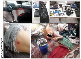 جراحی وحشتناک یک دزد در خانه کثیف!