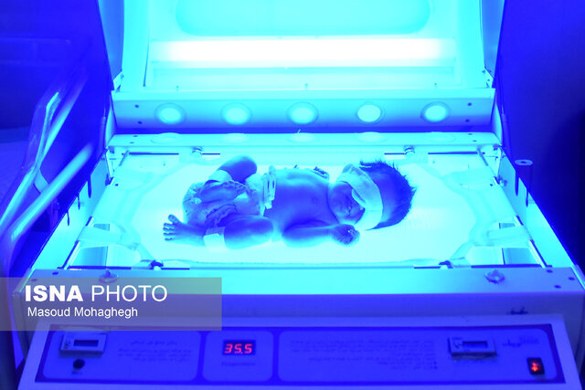 تولد نوزاد ۶۸۰ گرمی در بیمارستان بهار شاهرود