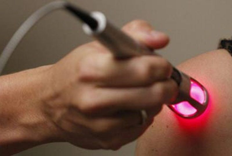 خدمات لیزر توسط پزشک عمومی بلامانع اعلام شد