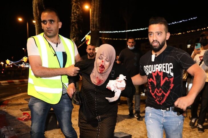 زخمی شدن ۵۳ فلسطینی در قدس اشغالی