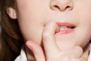  4 تا از مضرات جویدن ناخن