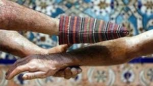 فواید کیسه کشیدن در حمام: توصیه هایی از طب سنتی